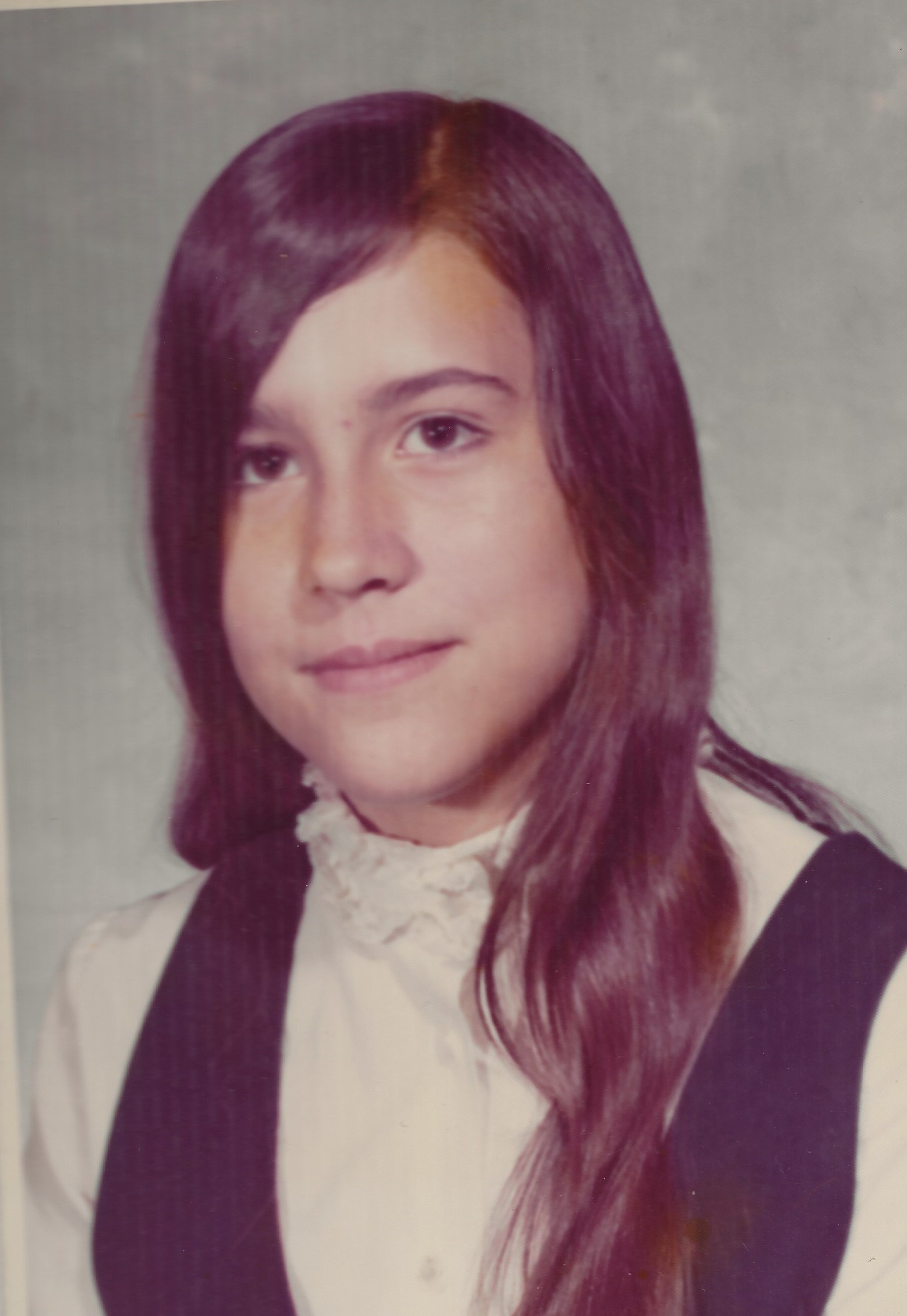 The photo is meant to illustrate the practical application of covering up my scar.